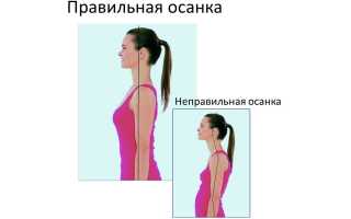 Причины и виды нарушения осанки