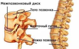Воспаление фасеточного сустава позвоночника