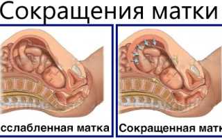 Тонус матки на 37 неделе беременности