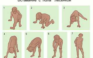 Симптомы и лечение миопатии Дюшенна