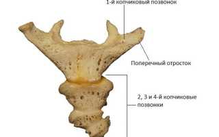 Перелом и трещина копчика: симптомы, лечение