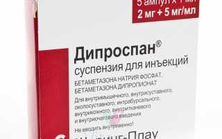 Уколы Дипроспан: показания к применению препарата