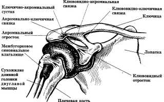 Что такое артроз акромиально-ключичного сочленения (АКС)?