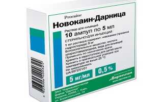 Что такое новокаиновая блокада?