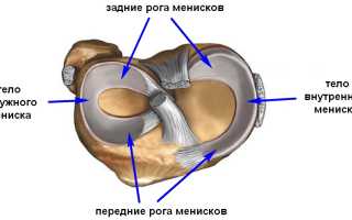 Операция на мениске коленного сустава, реабилитация