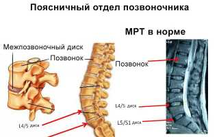 Подготовка к МРТпояснично-крестцового отдела позвоночника