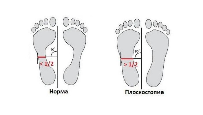 1106636