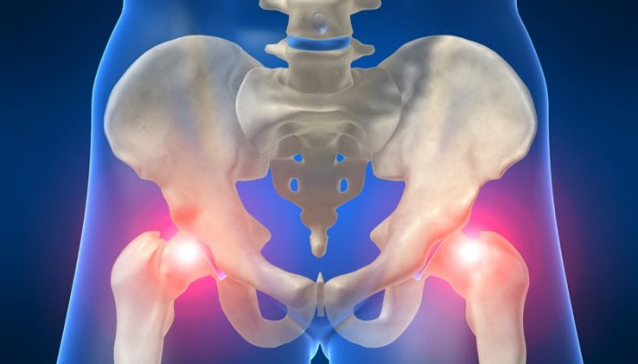 1303333169_hip-bursitis-anatomy-lg