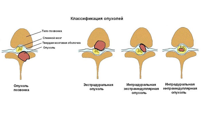 3_ru