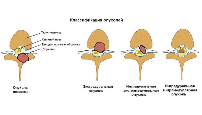 3_ru