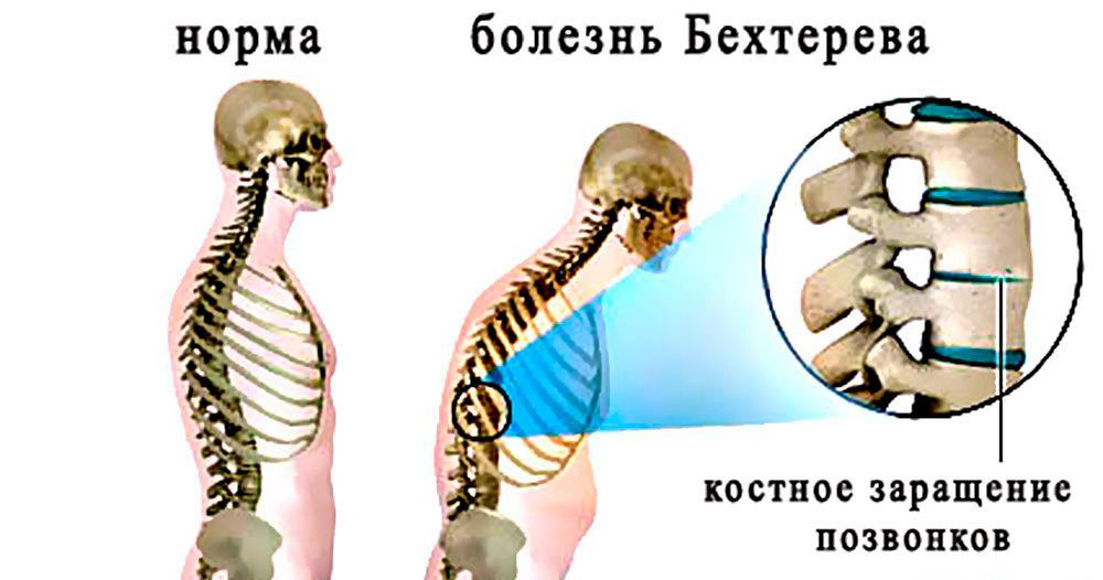 Osobennosti-patologii