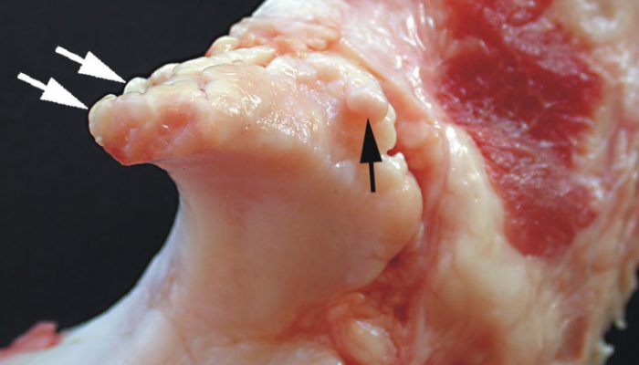 osteophytes_processus_anconeus