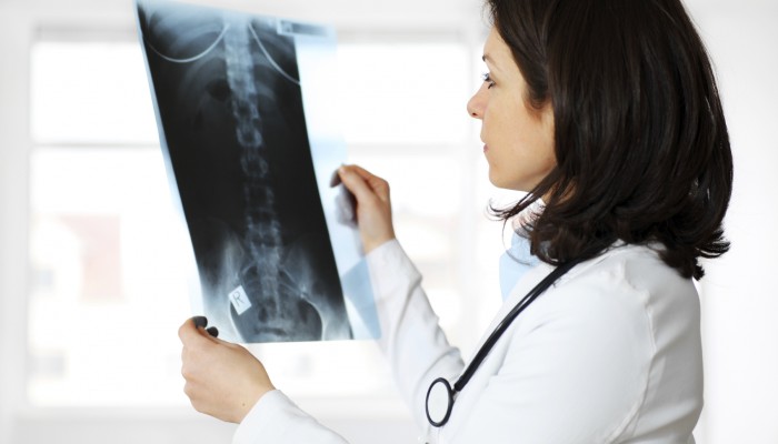 Female doctor looking at x-ray image on workplace.