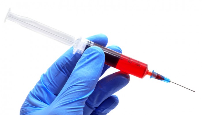 Someone wearing medical gloves holding a syringe with blood