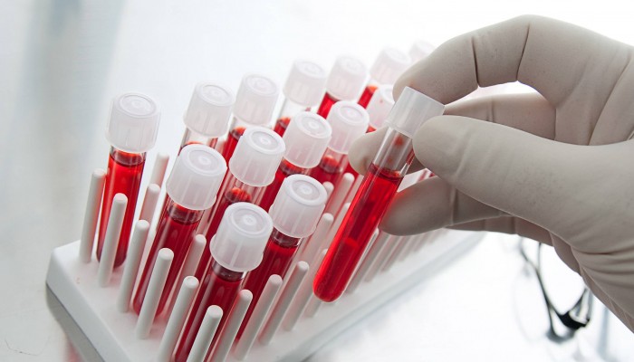 bloodtest