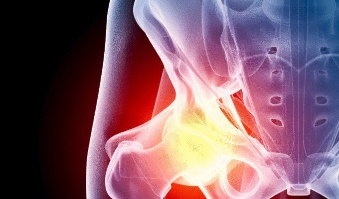 content_exercises_with_osteoarthritis_of_the_hip_joint__econet_ru
