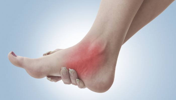 diabetic_polyneuropathy_1