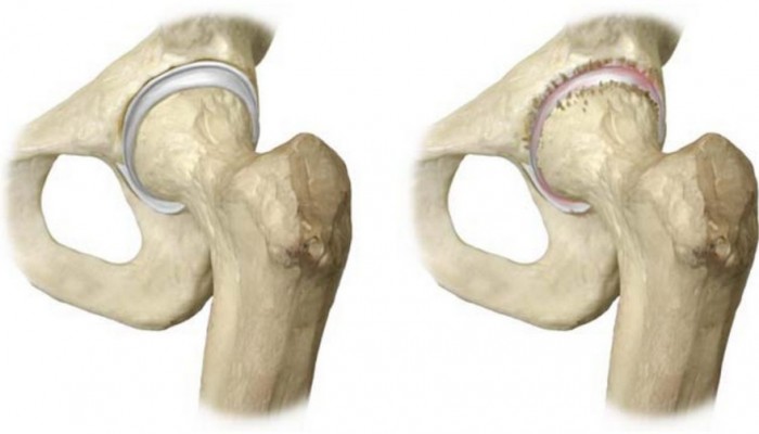 fig3