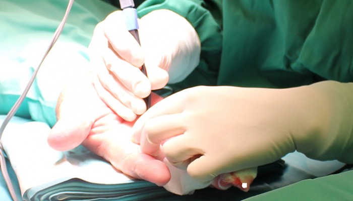 hand-surgery