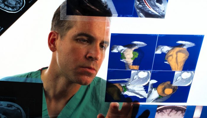 Doctor Looking at X Rays