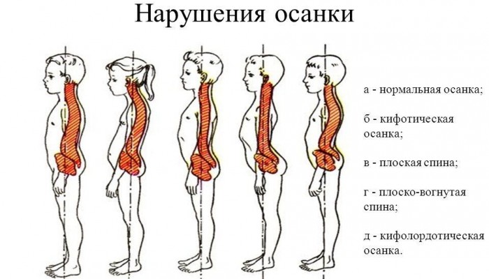 prezentatsija-na-temu-narushenija-o_4