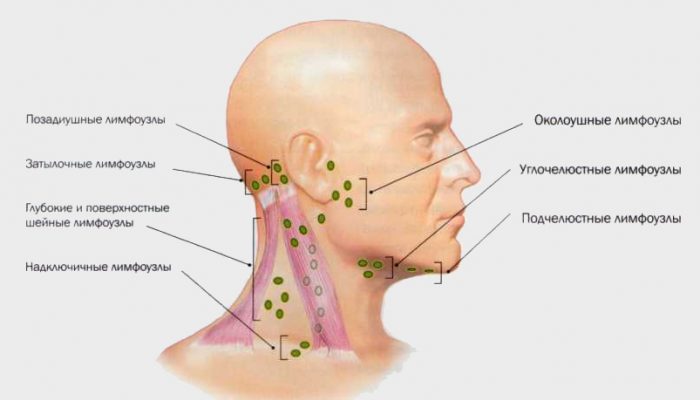simptomy-vich-limfouzly
