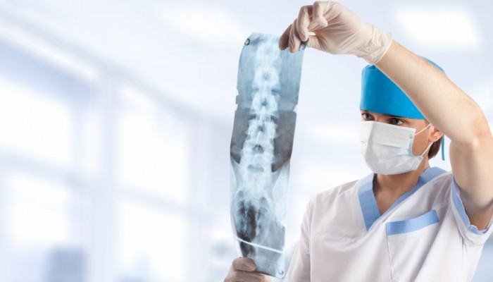 medical doctor looking at x-ray picture of spinal column in hospital with copy space