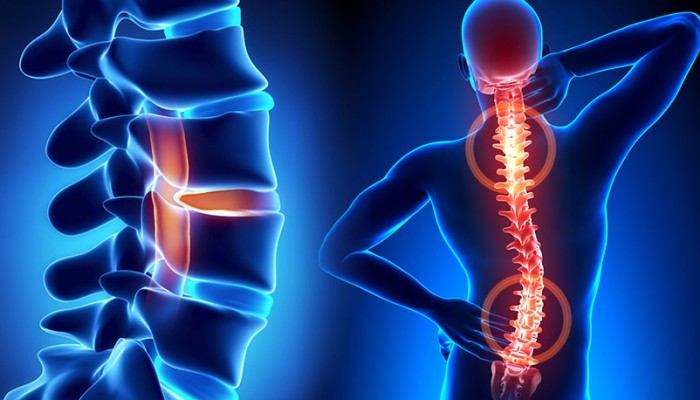 spine-(1)1