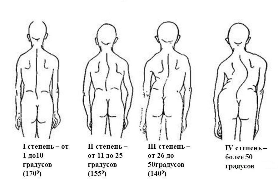 stepeni-1
