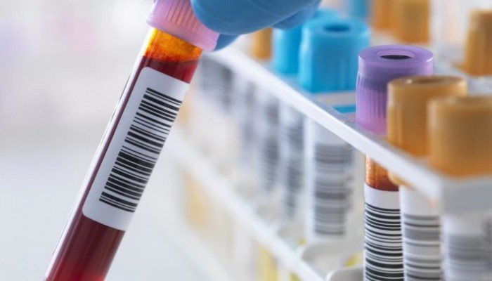 were-blood-tests-required-before-marriage_16fa496b264f21101-720x405