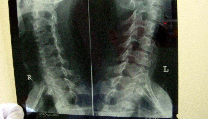 x-ray