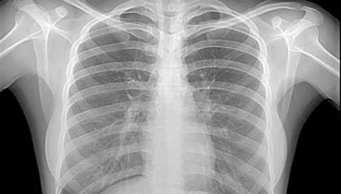 xray
