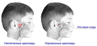 Разрез