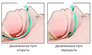 Схема
