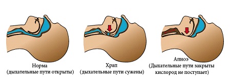 Схема