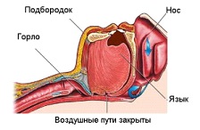 Схема
