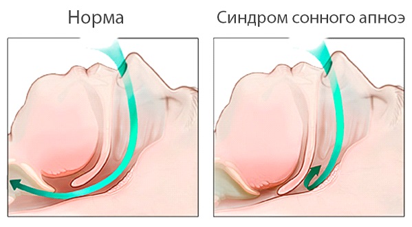 Схема