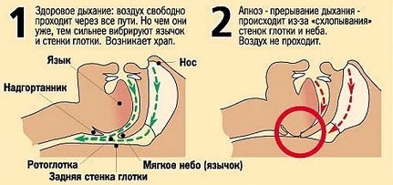 Схема