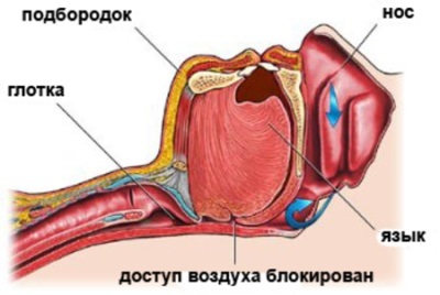 Разрез