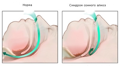 Схема