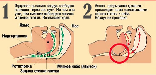 Нормальное и ненормальное состояние Картинка
