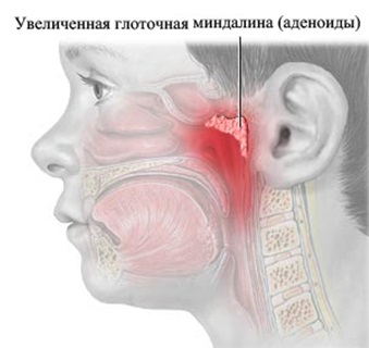 Схема