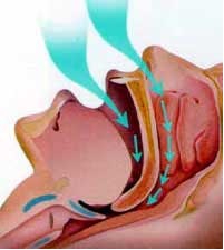 Струи